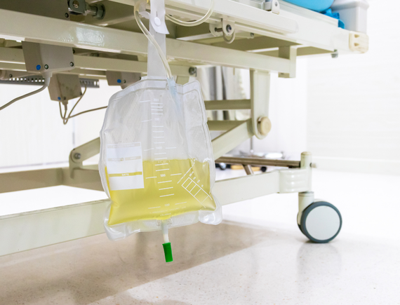 Evde Sonda Takma/Çıkarma Hizmeti